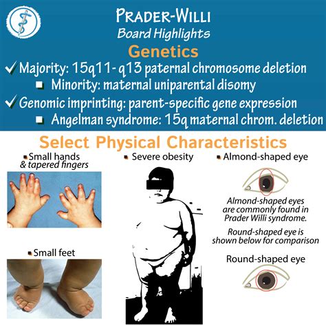 prader-willi syndrome pictures